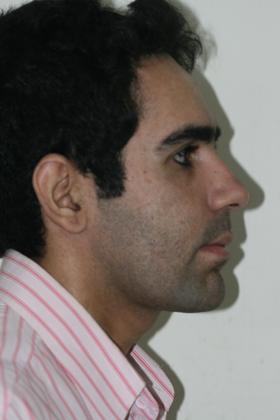 After image