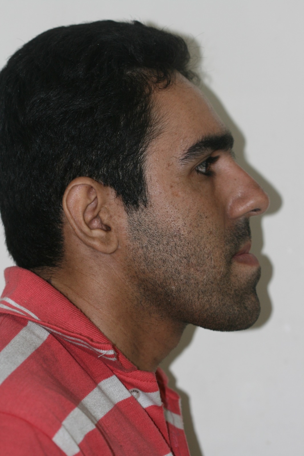 Before image