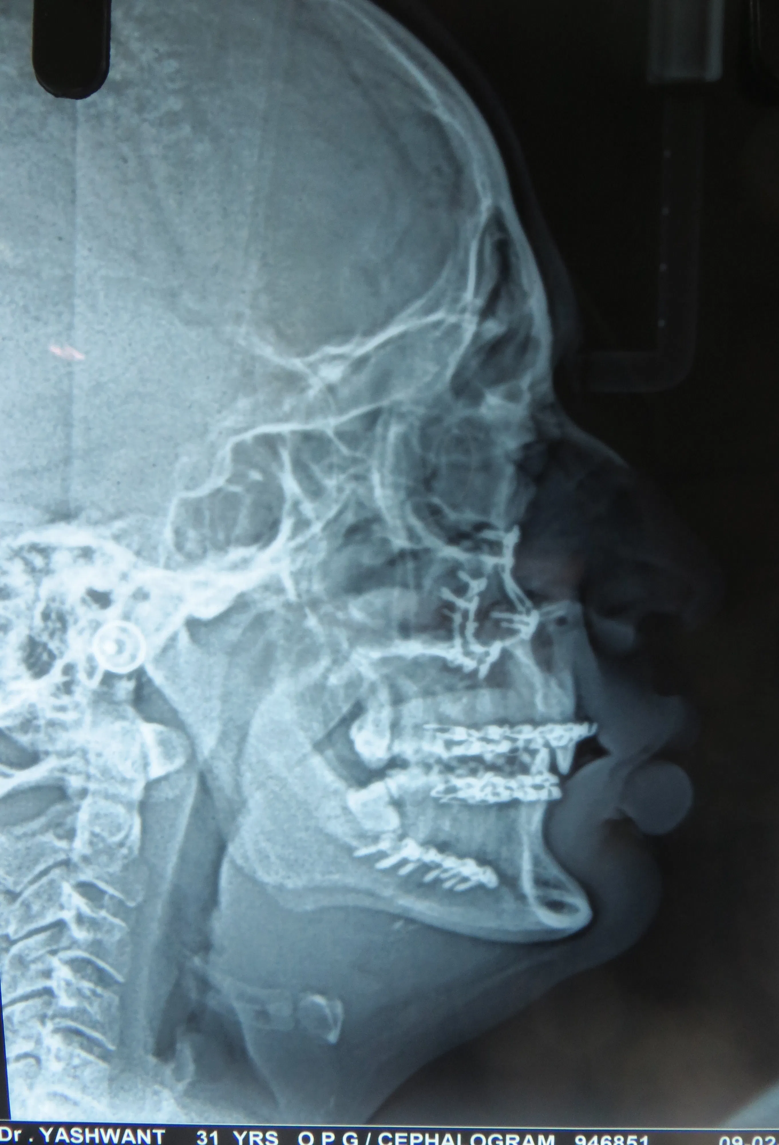 After image