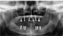 After image