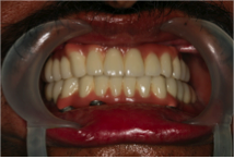 Before image