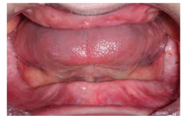 Before image